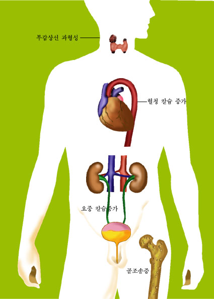 의약품 이미지